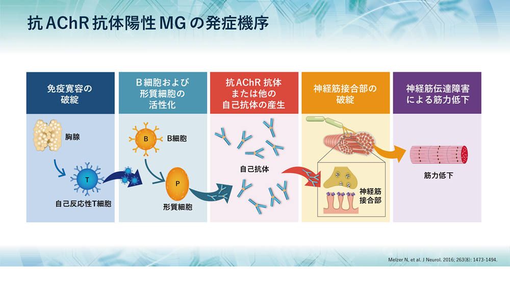 重症筋無力症の病態における補体の関与 Mg Forum 重症筋無力症の病態における補体の関与 Mg Forum