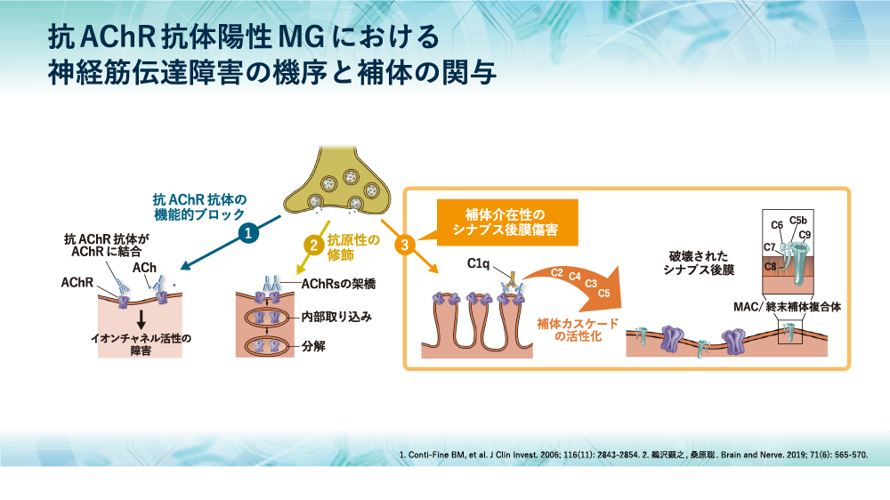 重症筋無力症の病態における補体の関与 Mg Forum